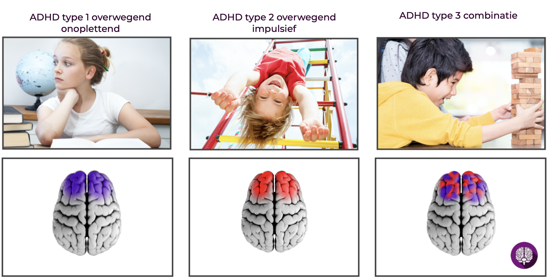 Ik leer anders » Beelddenken en ADHD / ADD